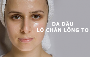 Da dầu, lỗ chân lông to, làm thế nào để cải thiện?