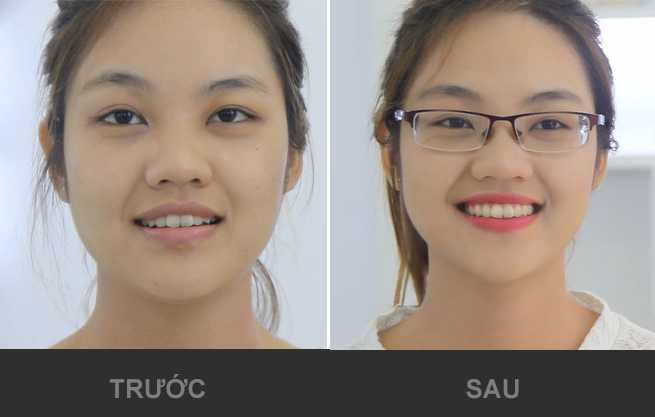 Bí quyết hóa girl xinh chỉ trong 5 phút!