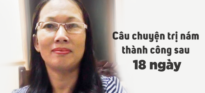 Câu chuyện trị nám thành công sau 18 ngày