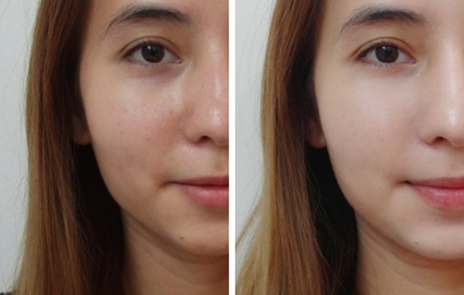 Xóa nhăn, chống lão hóa, làm sáng da tưởng khó mà hóa dễ