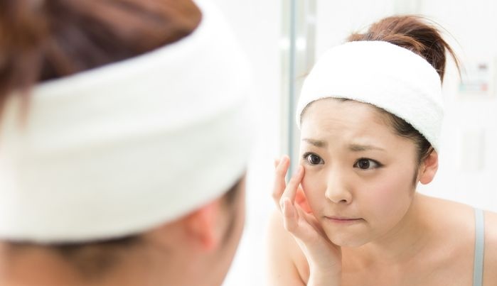Bạn gái - Mụn - Cách phòng ngừa và điều trị