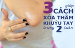 3 cách siêu đơn giản giúp loại bỏ da khô và sậm màu vùng khuỷu tay