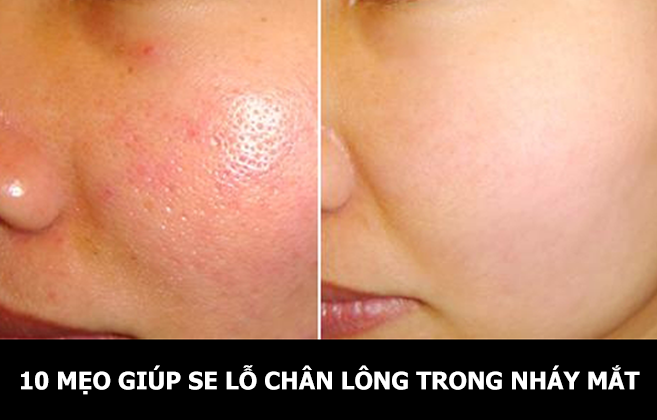 10 bí quyết thần kỳ giúp se lỗ chân lông trong nháy mắt!