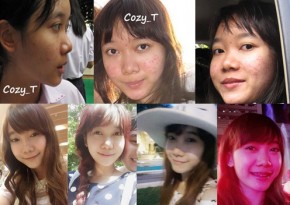 Sự thay đổi đáng kinh ngạc của thiếu nữ Thái mặt mụn, người mập