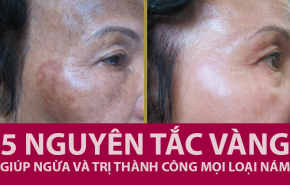 Thuộc ngay 5 nguyên tắc bất di bất dịch để da không bị nám!