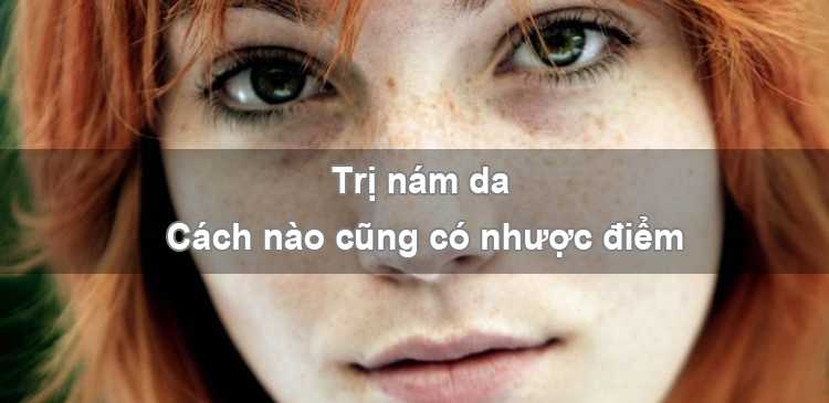 Trị nám da - cách nào cũng có nhược điểm