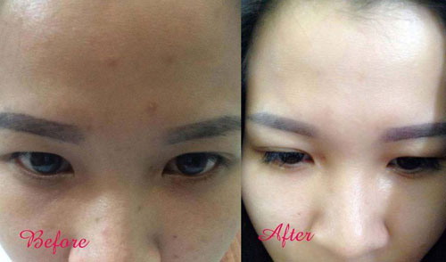 Cô gái cải thiện làn da trong 10 ngày bằng mật ong, sữa chua