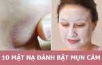 10 mặt nạ tự nhiên giúp thổi bay mụn cám không thể bỏ qua