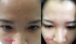 Cô gái cải thiện làn da trong 10 ngày bằng mật ong, sữa chua
