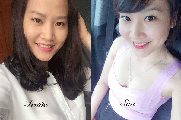 Làm trắng da mặt chỉ sau 1 tháng nhờ bột nghệ. Quá dễ!