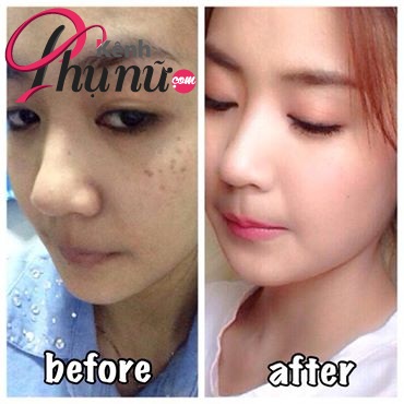 Làm thế nào để có được làn da trắng như ngọc chỉ sau 2 tuần?