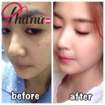 Làm thế nào để có được làn da trắng như ngọc chỉ sau 2 tuần?