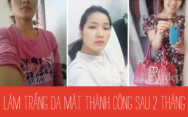 Bí quyết làm trắng da mặt thành công chỉ sau 2 tháng