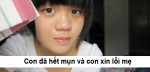 Con đã hết mụn và con xin lỗi mẹ
