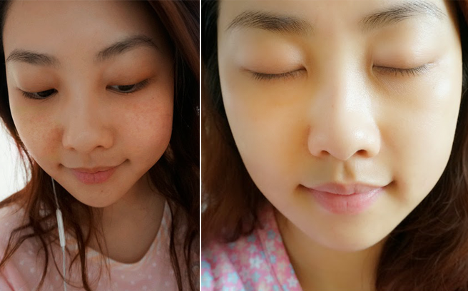 Lột xác cho da trắng hồng mịn màng chỉ trong 6 tuần!