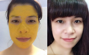 Mình đã có làn da sáng mịn như em bé nhờ tinh bột nghệ