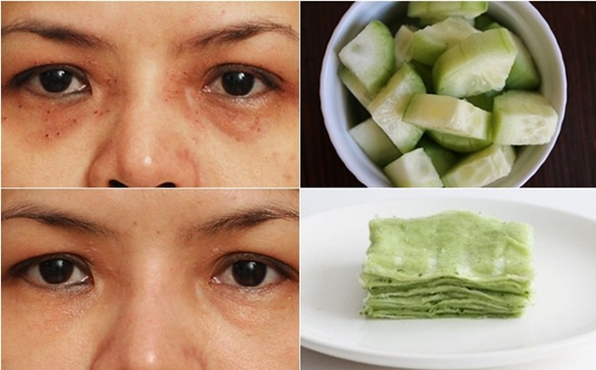 Đánh tan bọng mắt, quầng thâm chỉ trong 5 phút với dưa chuột