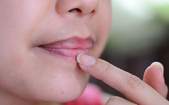 7 mẹo hay giúp trị môi thâm hiệu quả