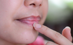 7 mẹo hay giúp trị môi thâm hiệu quả