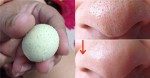Cách trị mụn đầu đen đơn giản bằng trứng gà cực nhanh