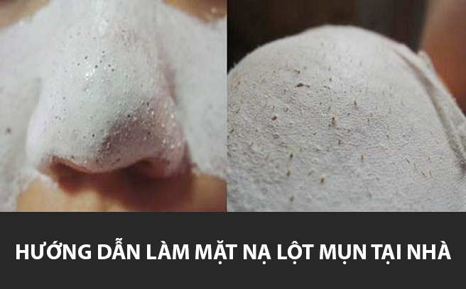 Hướng dẫn tự làm mặt nạ lột mụn đầu đen chỉ trong 3 phút