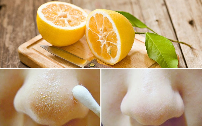 Mẹo hiệu quả nhất giúp trị mụn cám bằng nước chanh