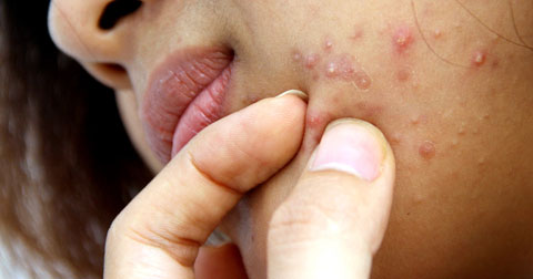 9-dau-hieu-tren-khuon-mat